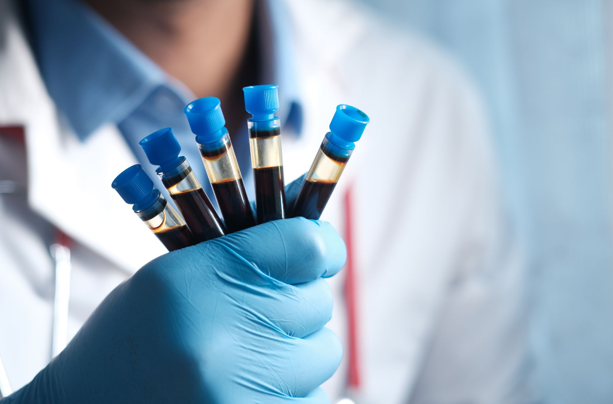 Medical Doctor Holding Blood Test Vials