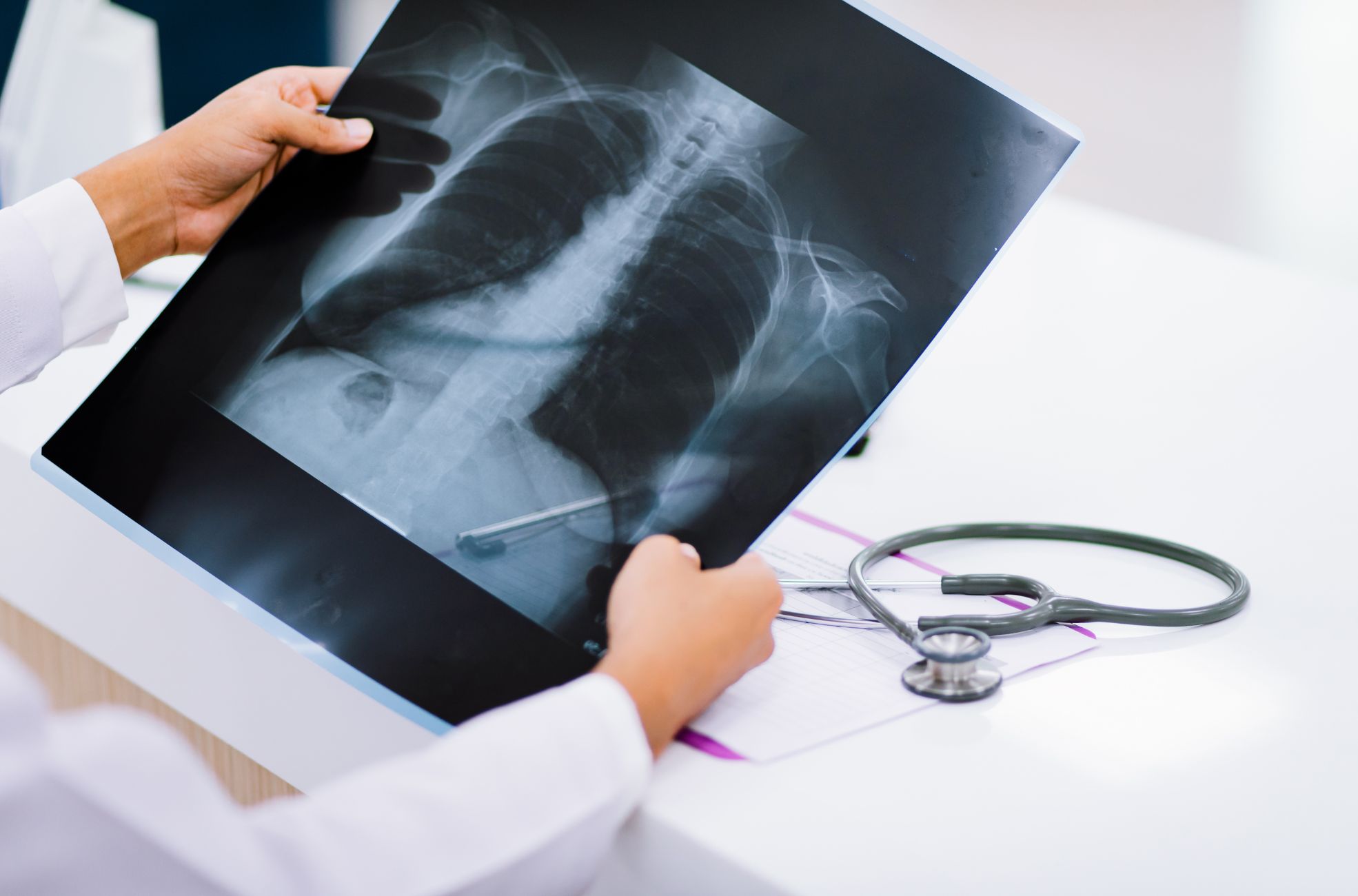 Medical Doctor Holding Chest X-Ray